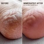 Heel Repair Duo - Image 7